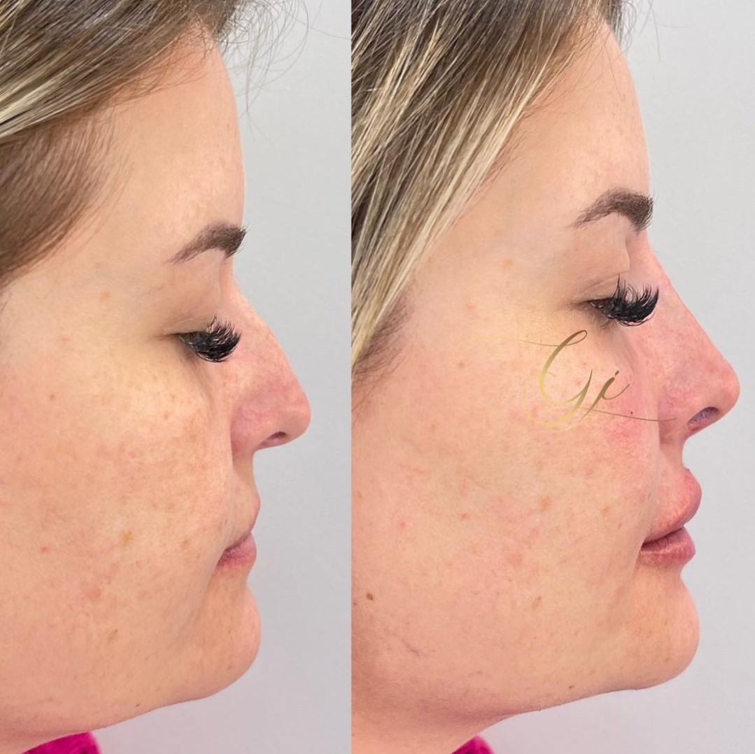 Dra. Gabriela Junqueira Harmonização Facial #5