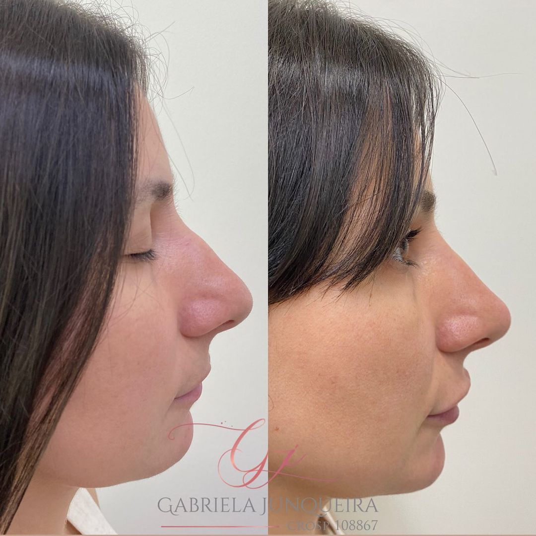Dra. Gabriela Junqueira Harmonização Facial #6