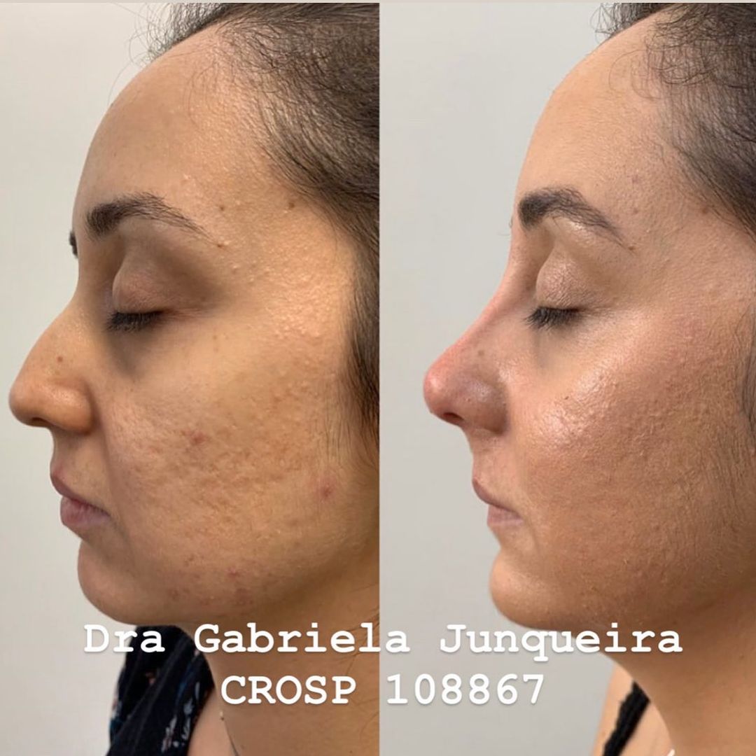 Dra. Gabriela Junqueira Rinomodelação #12